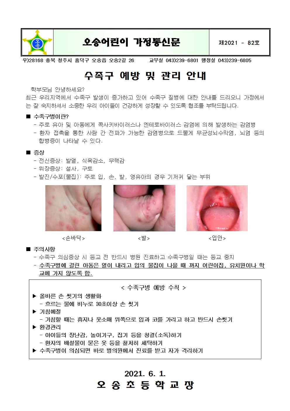 수족구 예방 및 관리 안내001